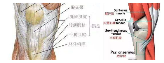 膝关节鹅足,有一种膝关节痛叫鹅足发炎