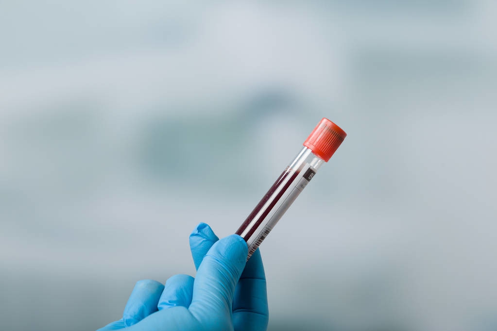 alt降低水平最快的方法,alt高了怎么快速降下来