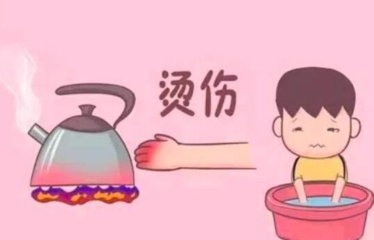 开水烫伤怎么办？烫伤第一时间该做这个