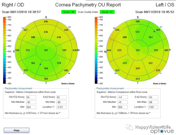 洞察超乳术后角膜的水肿