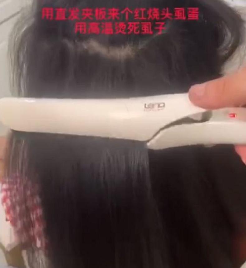 女孩上学被传染虱子怎么办,小女孩被传染上了虱子怎么办
