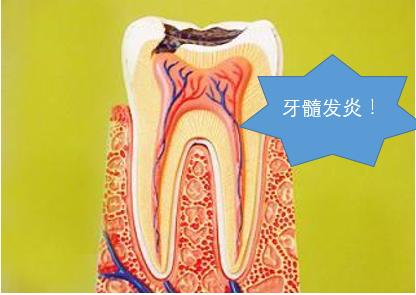 辟谣快速缓解牙疼,辟谣消炎药是抗生素