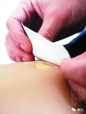 孩子爱出汗怎么调理饮食,小孩容易出汗是什么原因导致的