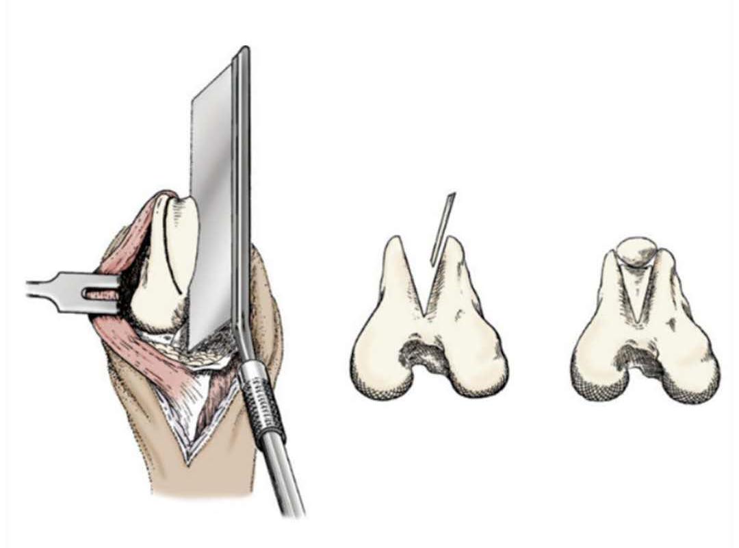 犬膝盖脱位,犬第一颈椎脱位