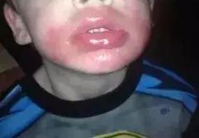 美白产品十大陷阱,各种美白成分的美白原理