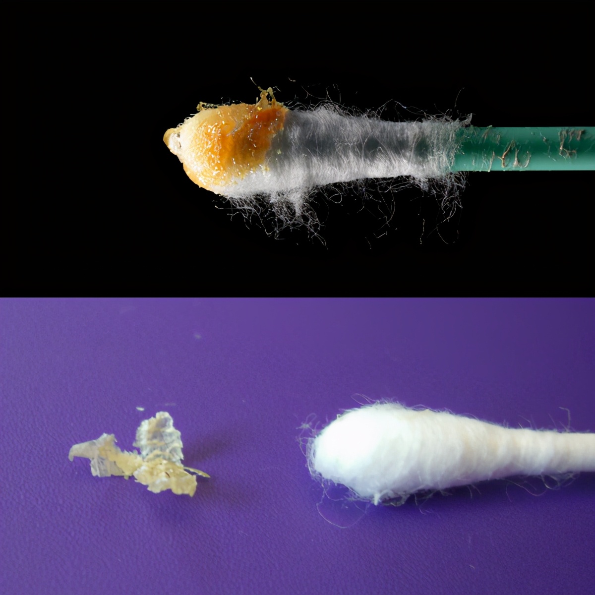 引起狐臭的真正原因到底是什么,狐臭是什么特征引起的怎么治疗