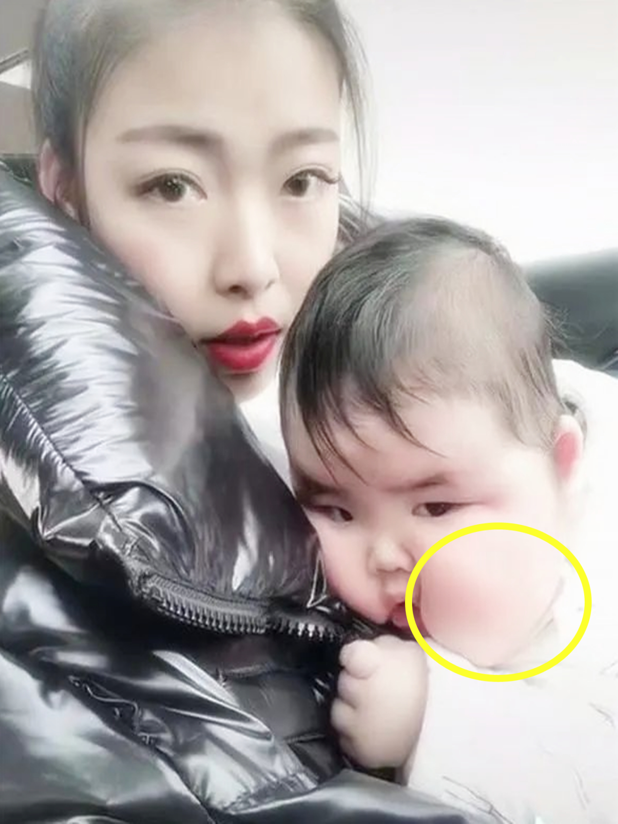 宝宝营养不良面黄肌瘦,宝宝偏食肥胖