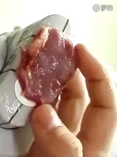 超声刀做了会让脸饱满吗,超声刀做后感触