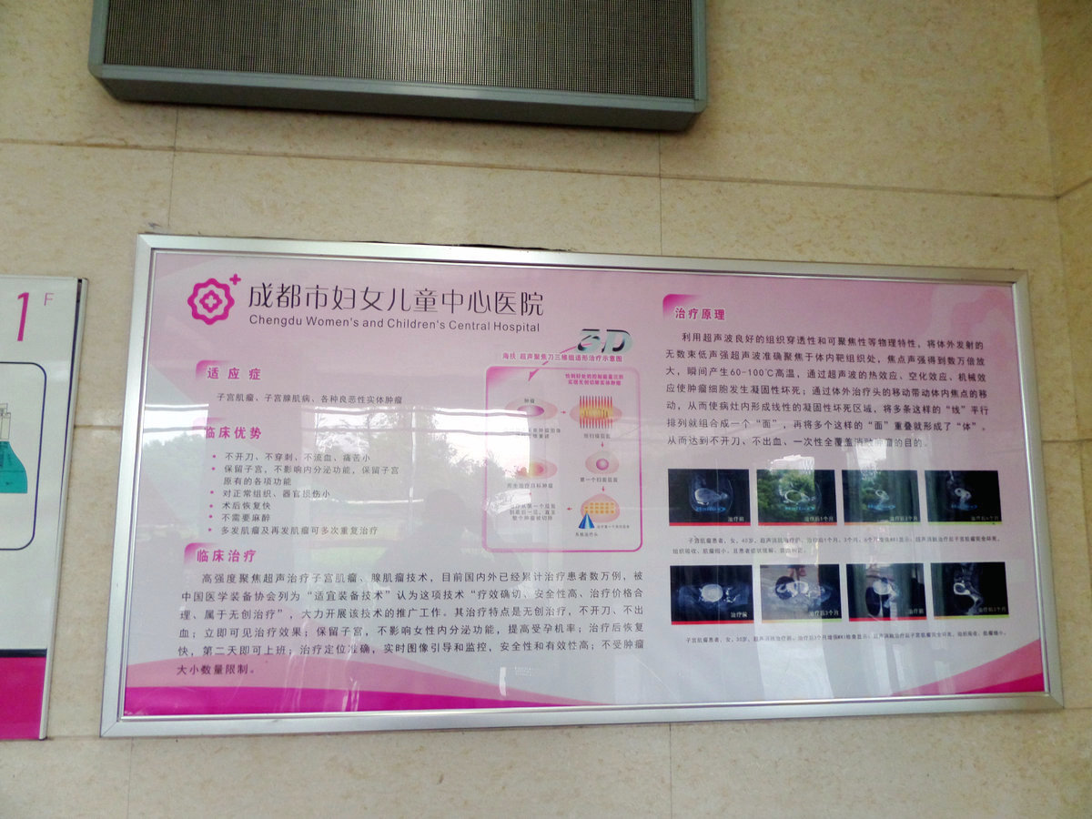 成都市妇女儿童中心医院,成都妇女儿童中心医院看妇科