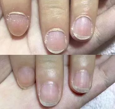 冬天脚后跟干裂用什么润脚霜,润足脚后跟干裂修复霜