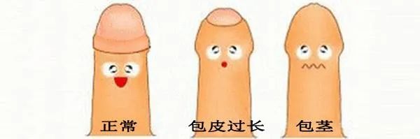 男性朋友知道这些，可以预防不育症发生！