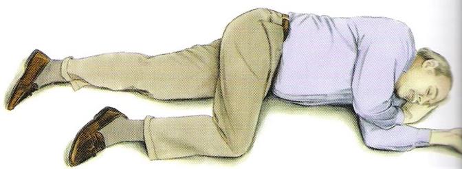 脑卒中预防知识,中风如何识别脑卒中