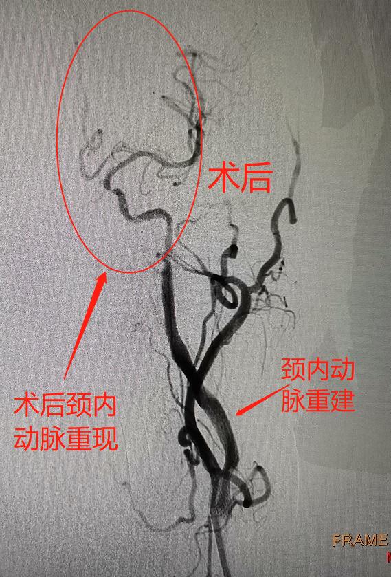 老人家突然浑身无力讲话不清楚,家中老人全身乏力是什么原因