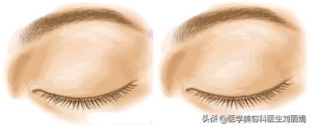 尚雯婕单眼皮吗,尚雯婕参加王牌视频