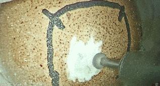 关于医疗纪录片推荐,不煽情却感人