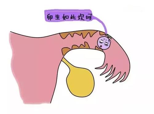 九成以上的宫外孕都出现在输卵管？3种措施避免这种情况再发生