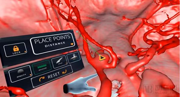 小医院可以用哪些医疗器械,医院里面的黑科技