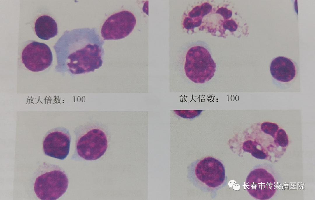 救命的3小时，惠民利民的“脑（膜）炎一站式快速诊断平台”望在全省逐步开展