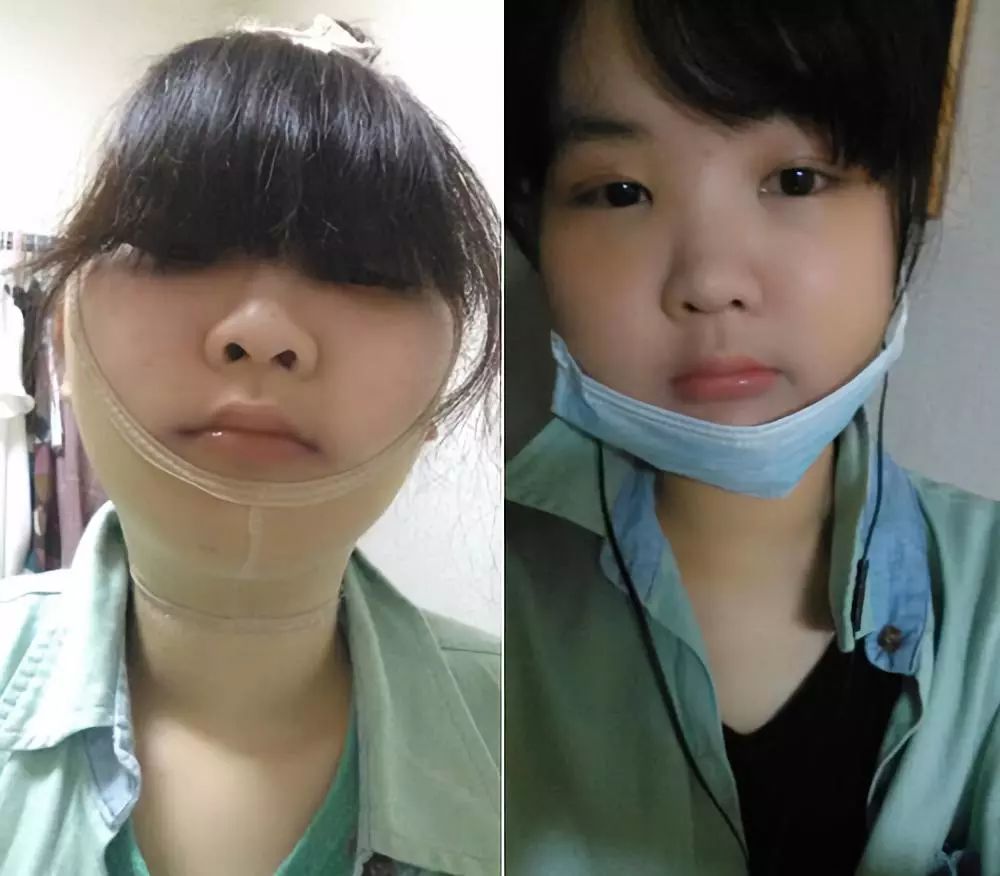 被整容毁掉女明星,被整容毁掉的中国女明星