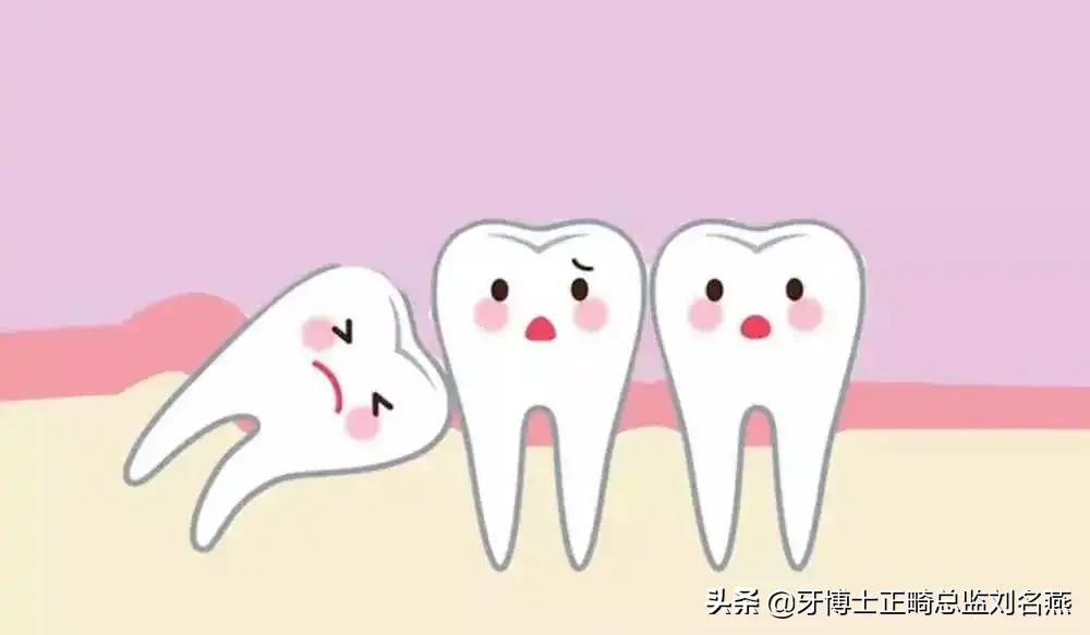 智齿拔除肿成猪头多久恢复,拔了智齿为什么脸肿了