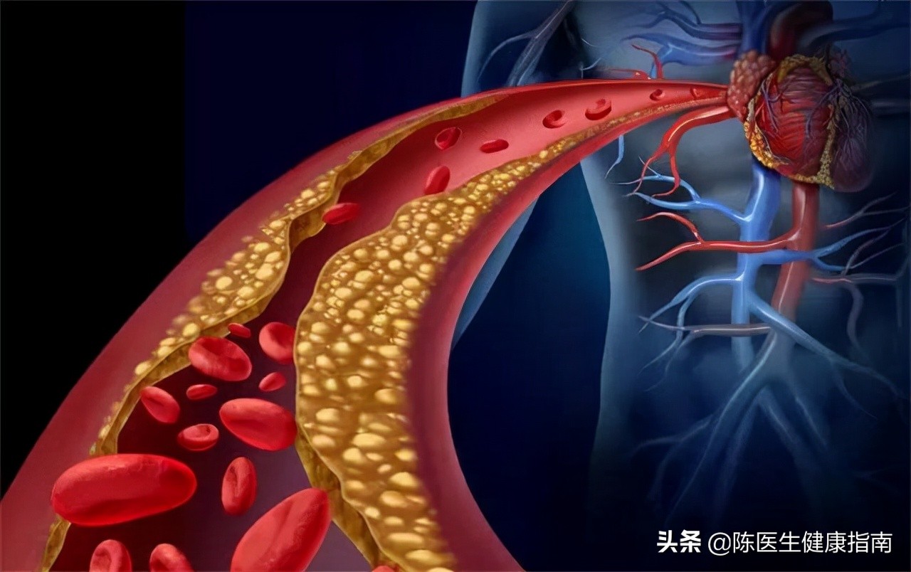 老年人脉压大怎么处理,老年人脉压差大是什么原因