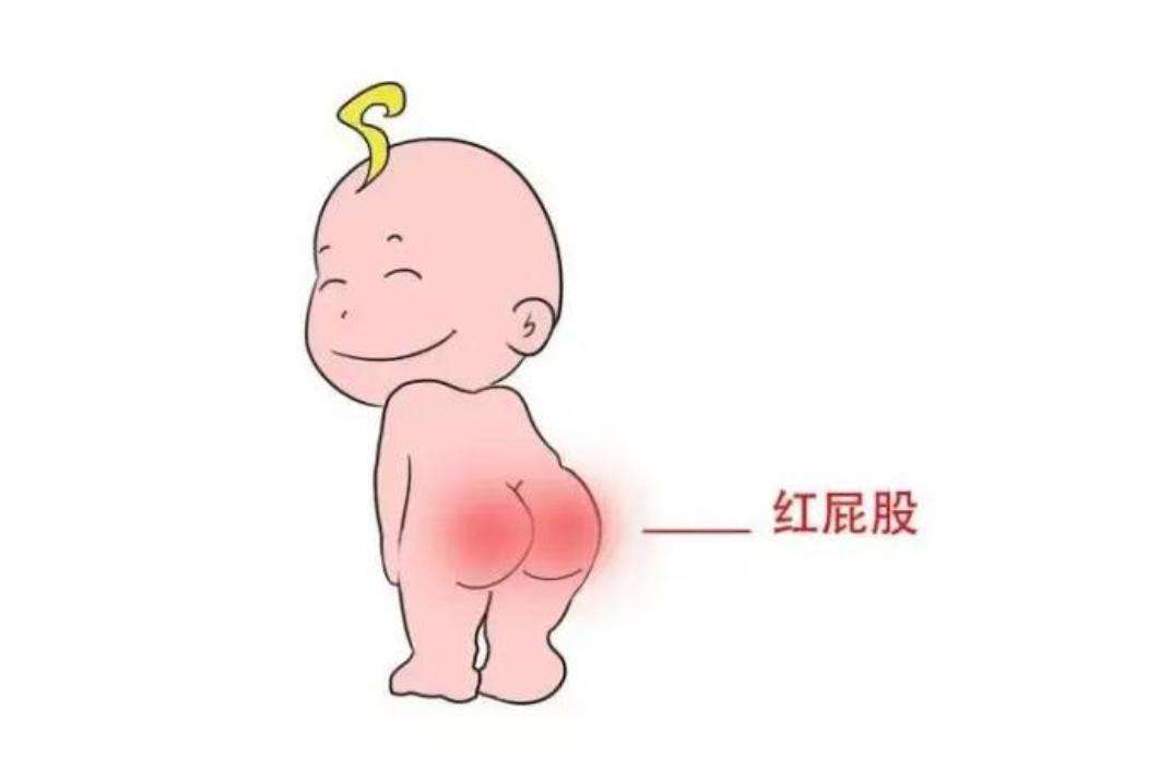 宝宝有了红屁屁怎么办,宝宝有红屁怎么办