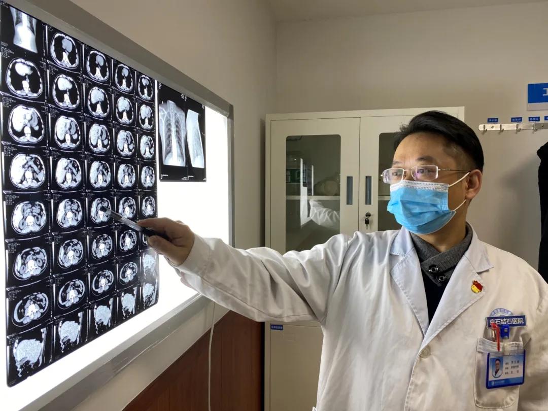 湖南​男子对肉食“情有独钟”，结果胆囊养出300颗“豆子”