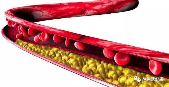 有心脏病牙疼怎么回事,牙疼是犯心脏病前兆吗