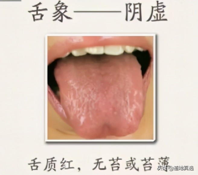 珍贵的舌诊图谱，看舌头知健康，人手一份！你也能快速识别疾病