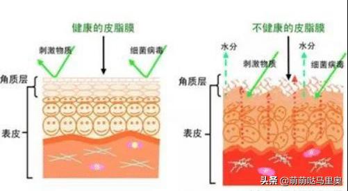 皮肤过敏和去角质有关吗,脸部过敏可以使用去角质啫喱吗