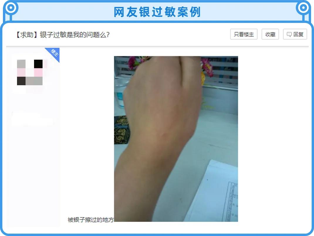 不要乱戴首饰,戴银饰要注意什么