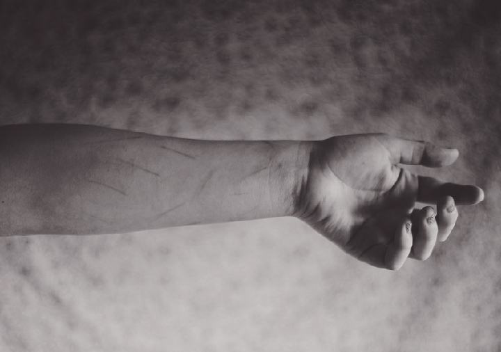 为什么做双眼皮比较扎心,做过双眼皮怎么变得更好看