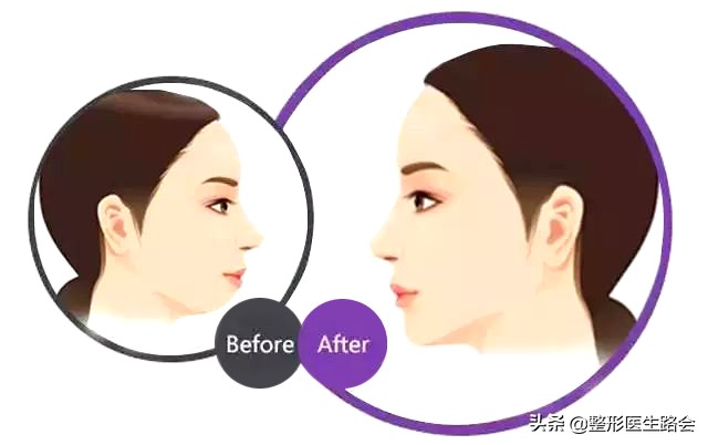 为什么侧颜没有下巴轮廓,侧颜怎么p下巴