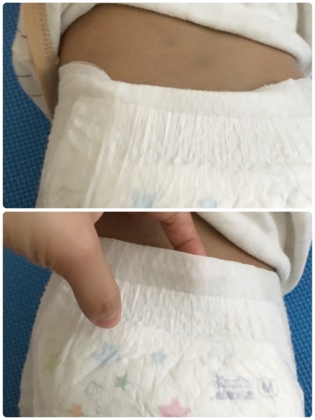 宝宝拉屎漏尿正确方法,宝宝红屁屁漏尿怎么回事
