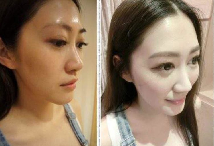 网红脸原来是这个样子,网红脸长相与平日长相的差别