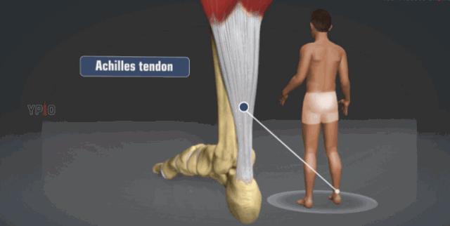 跟腱断裂康复论文,跟腱康复纪录片