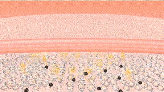 美白烟酰胺胶囊,烟酰胺美白祛斑