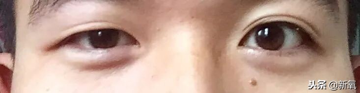 辛芷蕾是苦相女生吗,辛芷蕾气质怎么养成