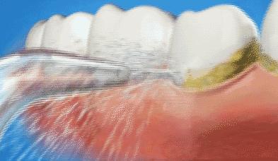 98%的人嘴里都有一颗“定时*弹炸**”，看看你中招了吗？