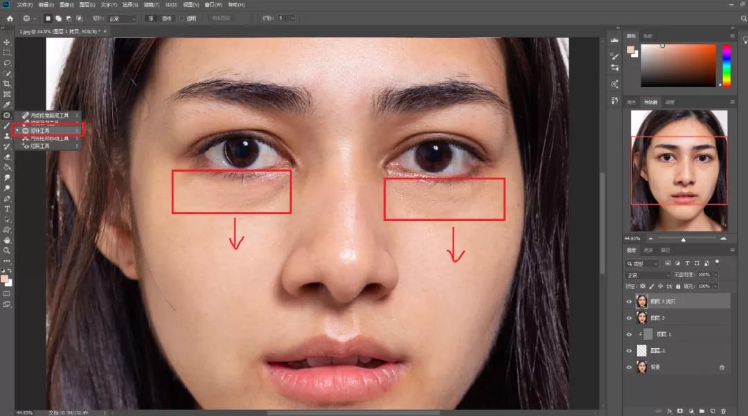 照片有黑眼圈怎么去除,照片怎么加黑眼圈