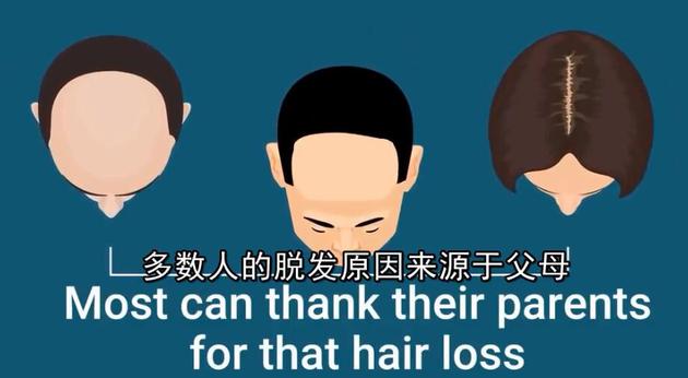 小贝热搜,小贝脱发