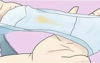 白带异常看中医,白带异常看妇科内分泌