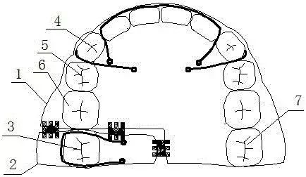 正畸主治学习视频,正畸钟摆效应名词解释