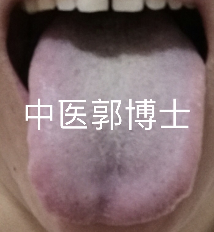 中医奇经疗法调理多种亚健康,中医经方加减治疗