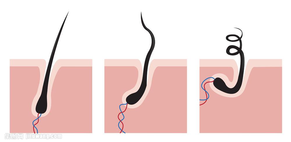 脱发没有毛孔了还能恢复吗,脱发后头发不长了怎么回事