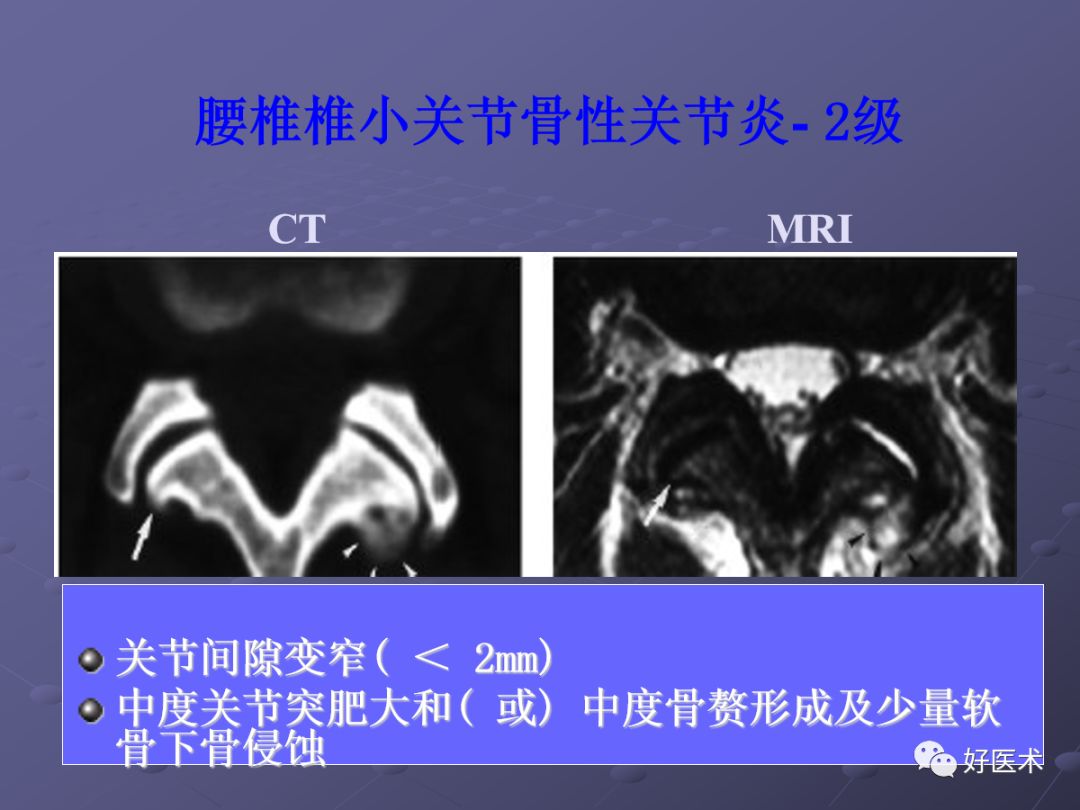 脊柱mri有哪些特点,乳腺疾病的mri诊断及鉴别