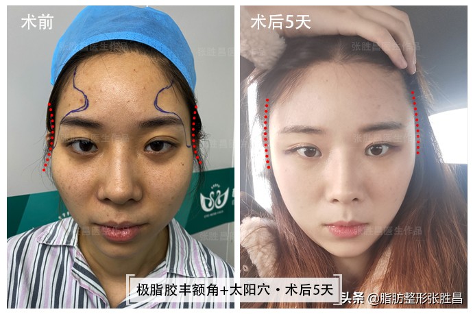 颧骨突出面相刻薄怎么办,脸型崎岖颧骨突出