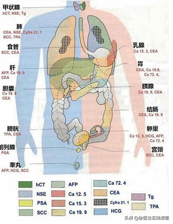 腹痛，肿瘤标志物高出几十倍，却查不出病因，这该怎么办？