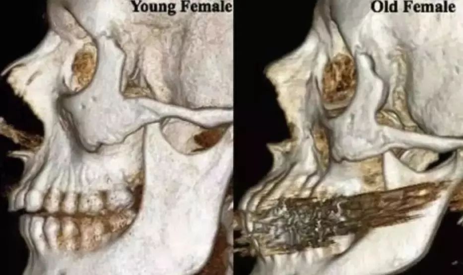 高圆圆方脸扎马尾,高圆圆方脸怎么整的