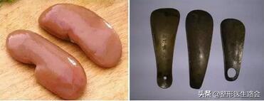 面中部凹陷下巴微翘,朱元璋式下巴怎么矫正